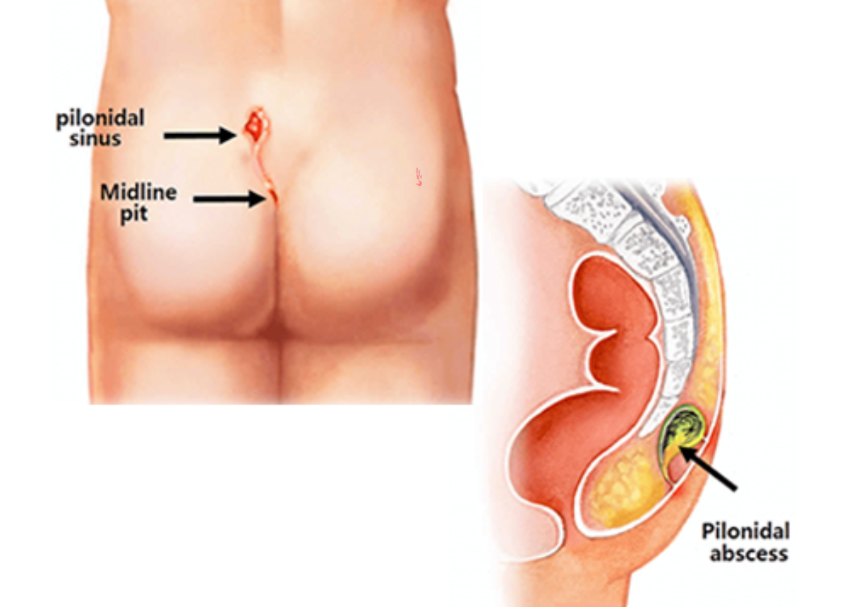 gynaecologists